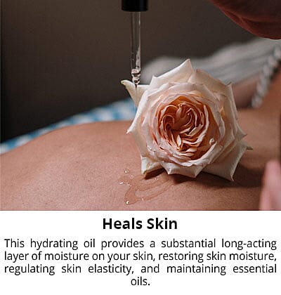 Heals Skin