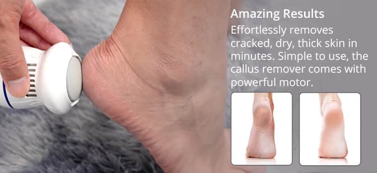 Buy White & Red Electric Foot Callus Remover with Two Speed Mode