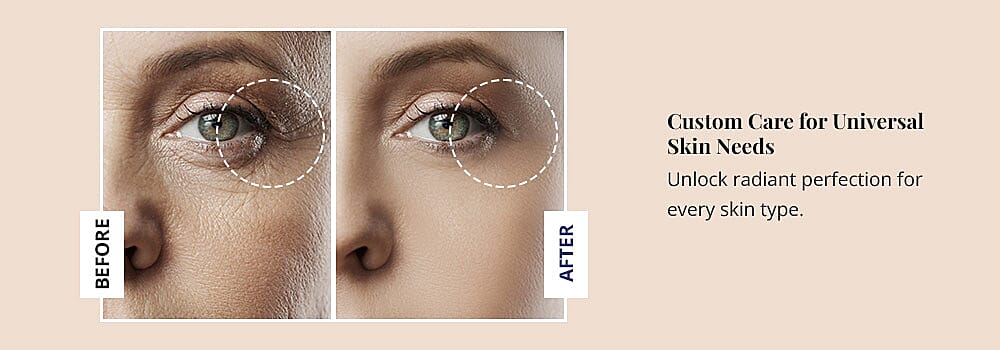 Custom Care for Universal Skin Needs Banner