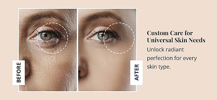 Custom Care for Universal Skin Needs Banner