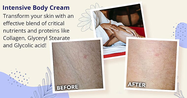 Intensive Body Cream Banner