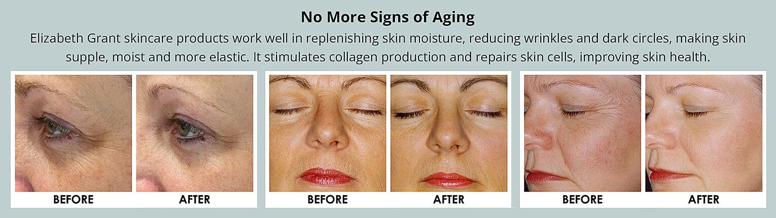 No More Signs of Aging Banner