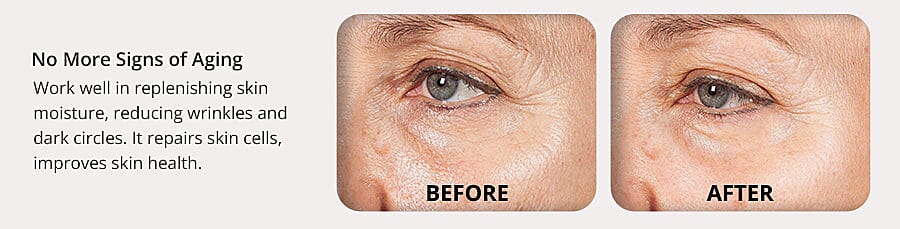 No More Signs of Aging Banner