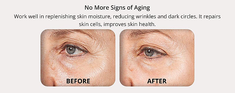 No More Signs of Aging Banner