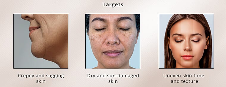 Elizabeth Grant Collagen Re-Inforce Pink SetBanner