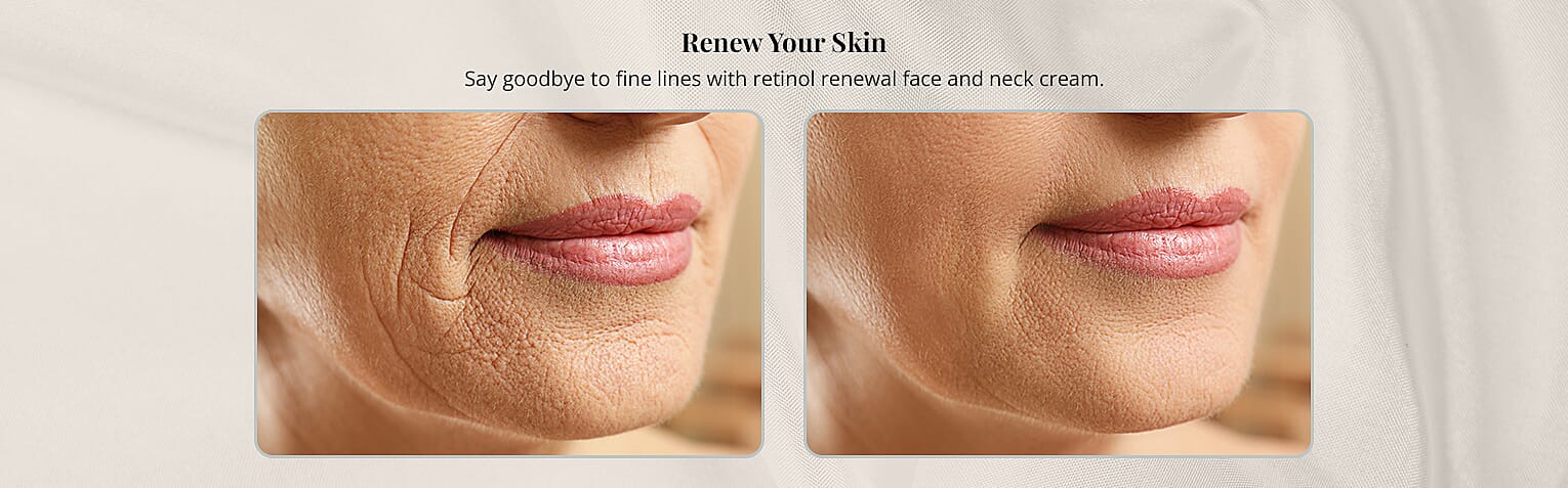 Renew Your Skin Banner