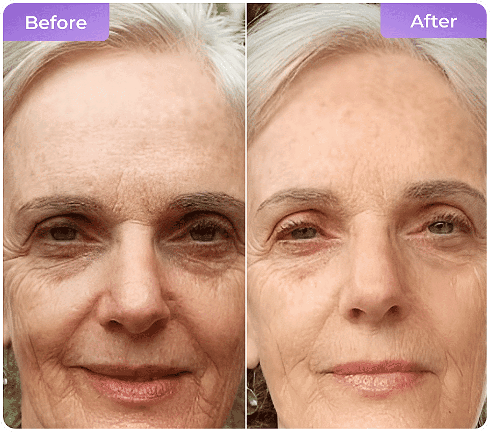 Before and After skin results