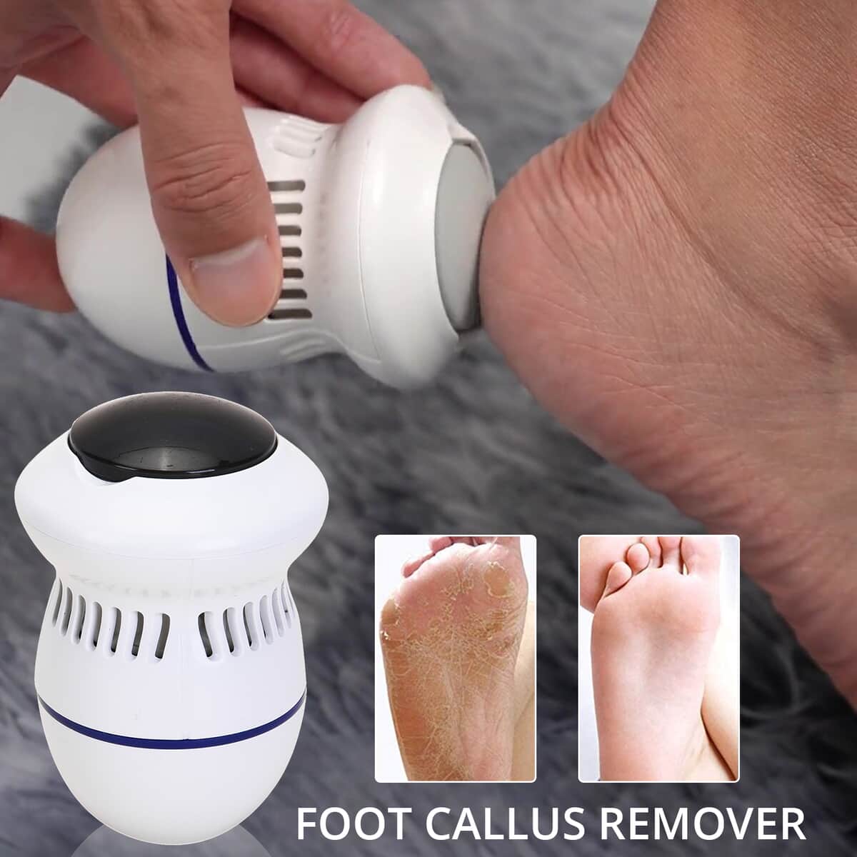 White & Blue Electric Foot Callus Remover with Two Speed Mode (Included: USB Cord, 1 Replaceable Emery Pad) (4.33"x2.95") image number 1