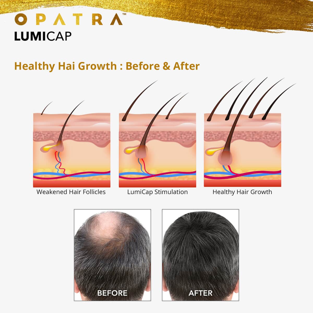 Opatra LumiCap Red Light Therapy Hair Regrowth Cap image number 3