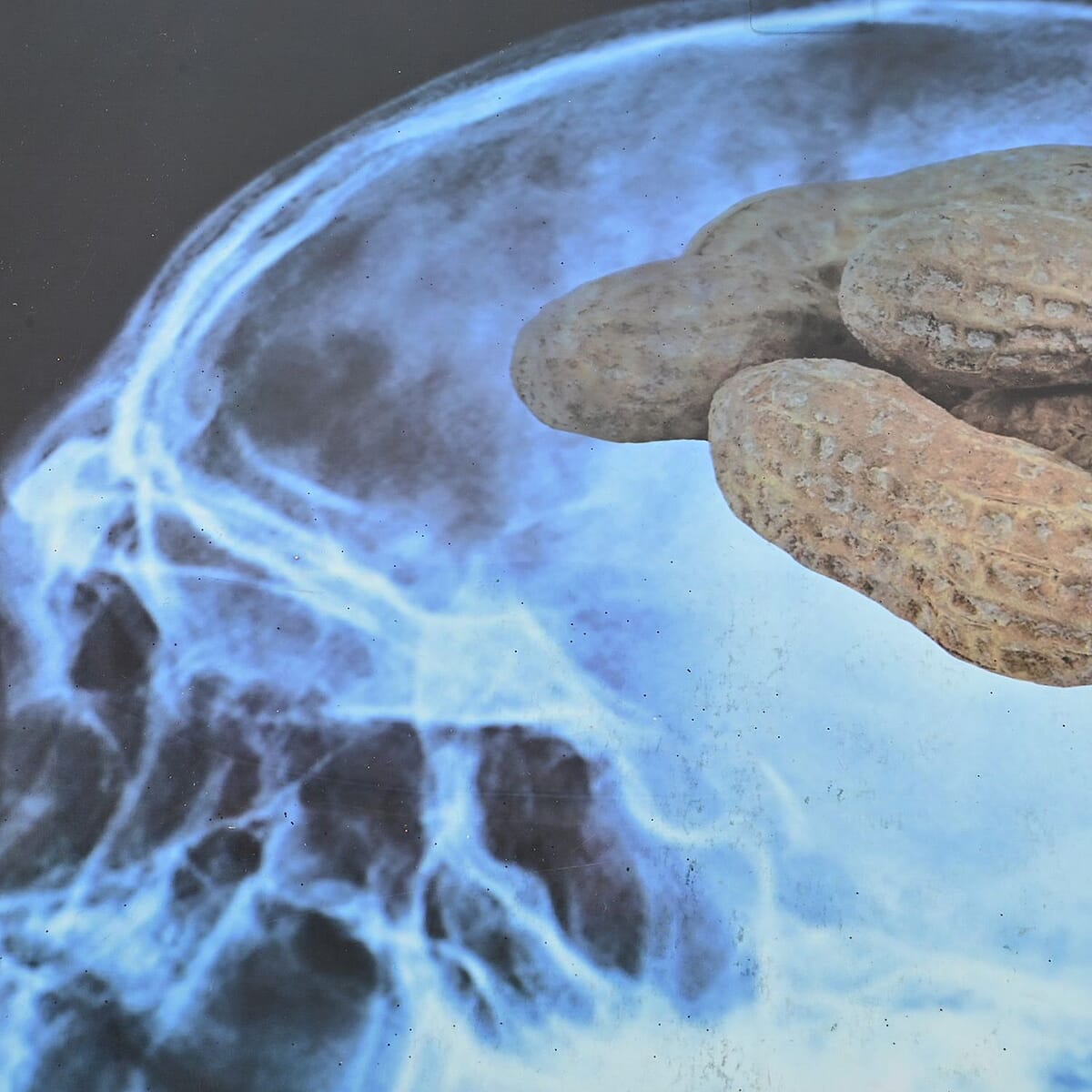 Halloween-Window Decor Skull Xray Gel Adhesive/halloween Hangtag image number 1