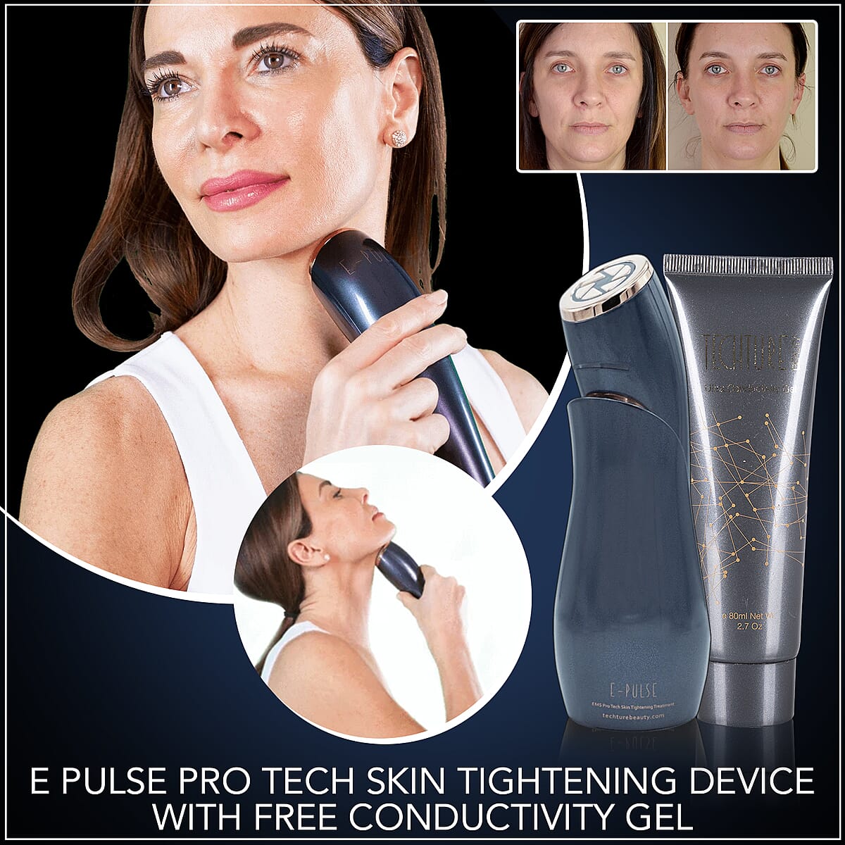 Techture Beauty E Pulse Pro Tech Skin Tightening Device with Free Conductivity Gel -Lifetime Warranty image number 1
