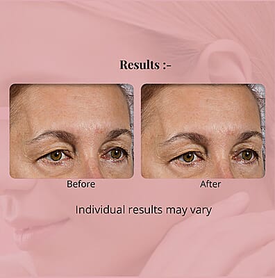 Elizabeth Grant Collagen Re-Inforce Multi-Peptide Miracle Serum 3.2 Fl Oz, Face Serum For All Skin Type