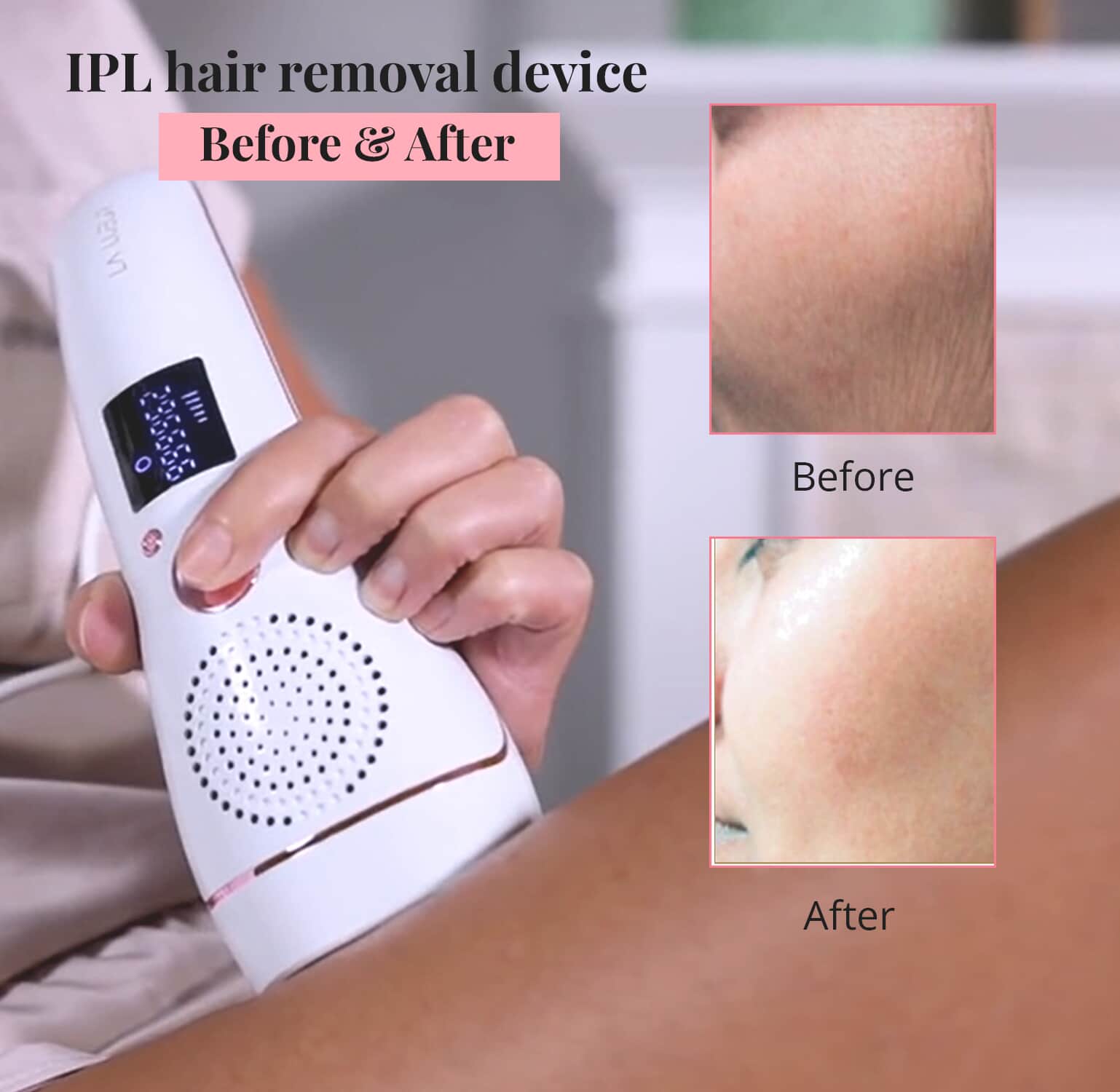 Luna Mour ICE Cool IPL Hair Removal Device Photofacial