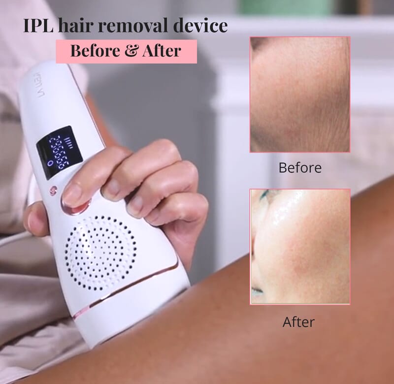 Luna'Mour ICE Cool IPL Hair Removal Device & Photofacial