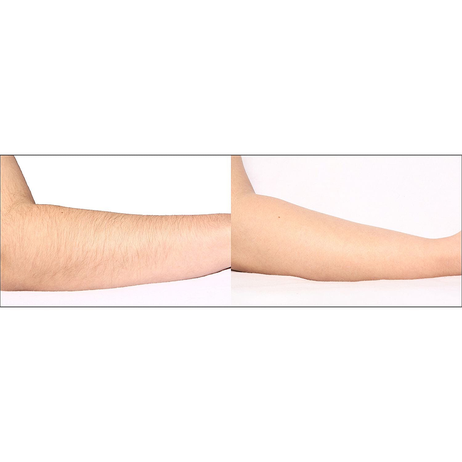 Closeout FDA Cleared Silk'n Refurbished Hair Removal Device with HPL Technology