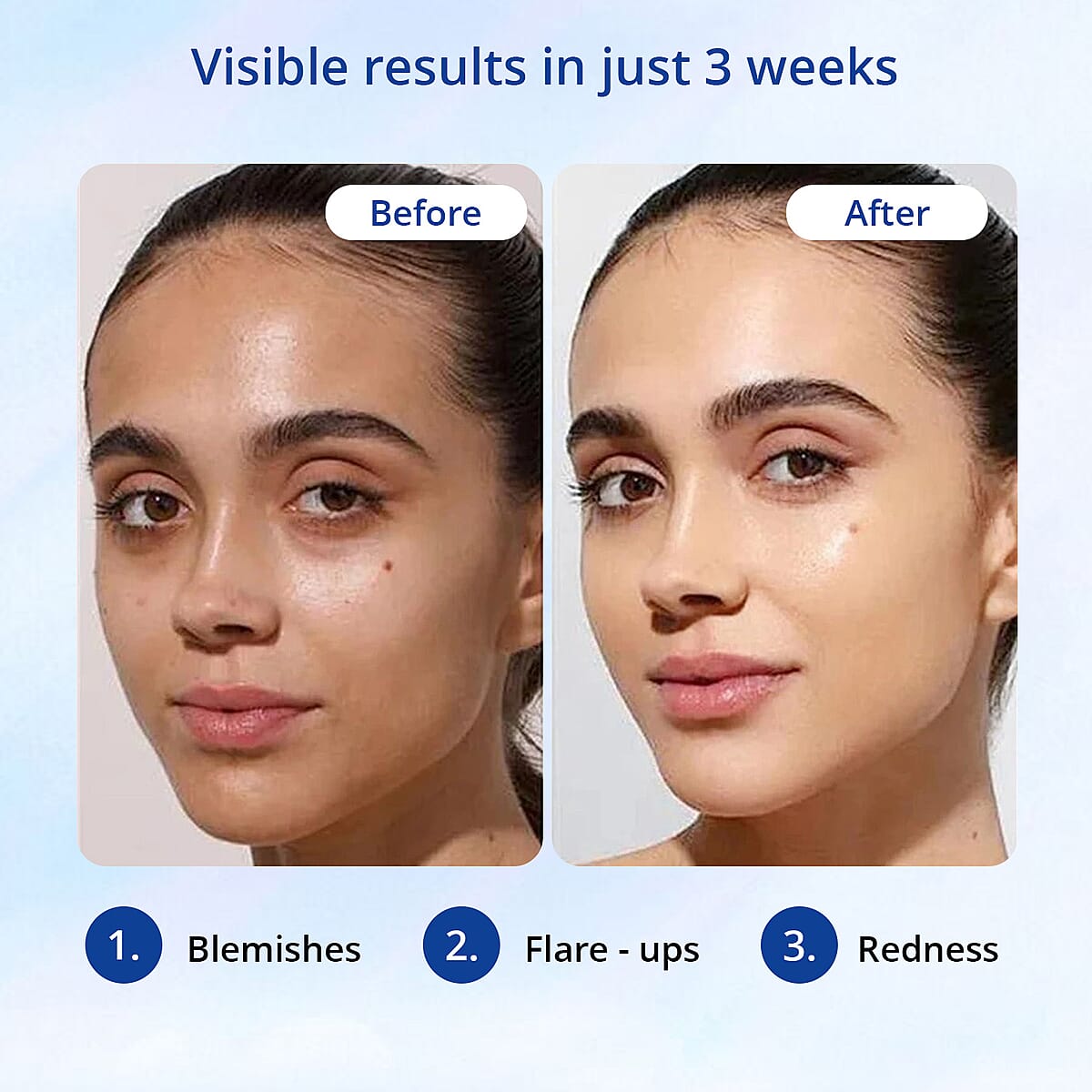 Fabulift Face 3 Minute Miracle 30 ml  image number 4