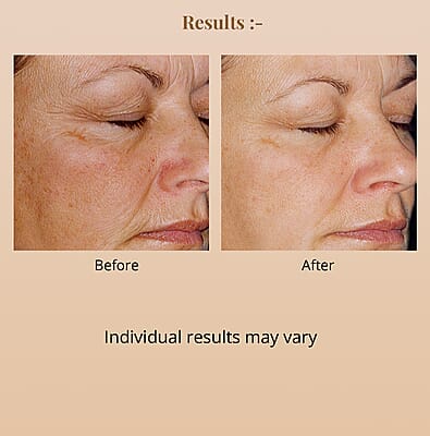 Elizabeth Grant Supreme Essence of Torricelumn 4.9oz, Anti Aging Face Serum For All Skin Types