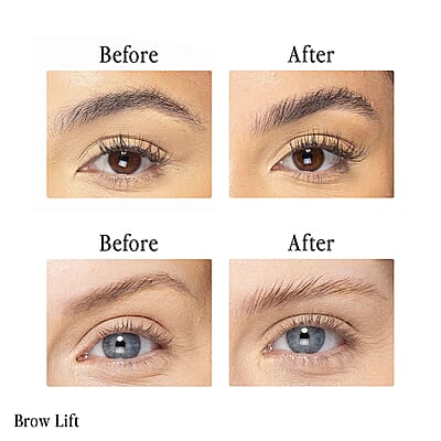 Billion Dollar Beauty Brow Lift