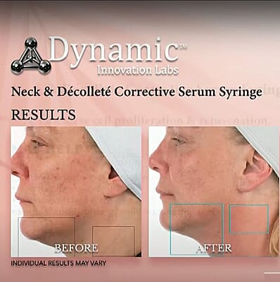 Dynamic Innovations Neck & Decollete Corrective Serum (Syringe)