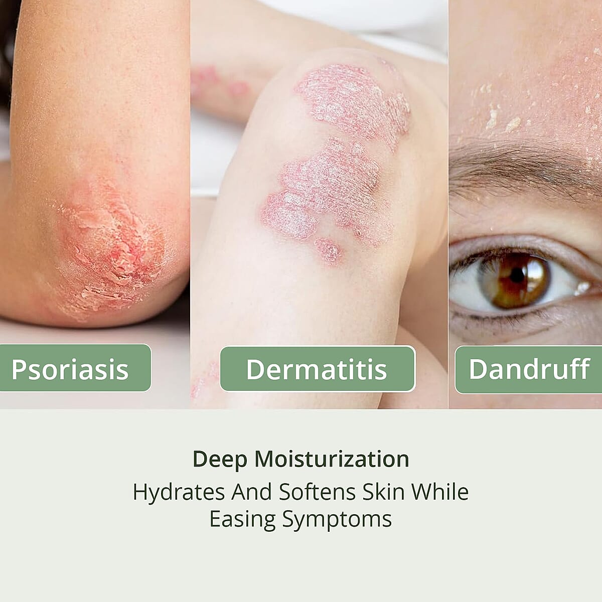 Dermabon Set of 3 Multi- Symptoms Psoriasis Cleanser Soap for Soothing (Ships in 3-5 Business Days) image number 4