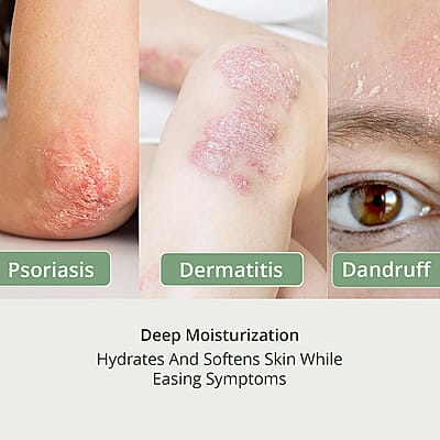 Dermabon Set of 3 Multi- Symptoms Psoriasis Cleanser Soap for Soothing