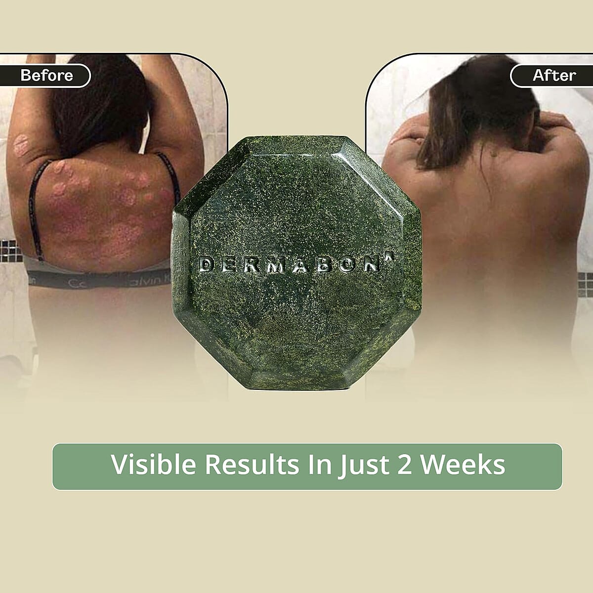 Dermabon Set of 3 Multi- Symptoms Psoriasis Cleanser Soap for Soothing (Ships in 3-5 Business Days) image number 5