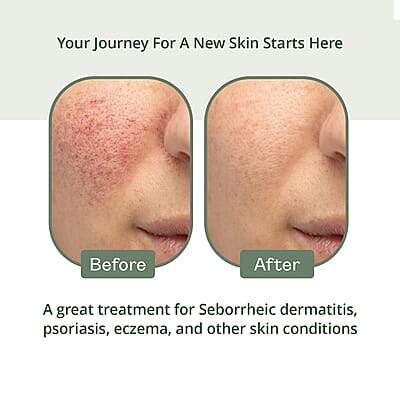 Dermabon Moisturing Skin Cream with Calendula Extract for Sensitive Skin (4oz)
