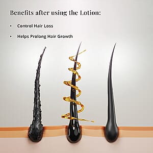 Mark Birch Trichologist TR3 Double Strength Scalp Therapy Lotion (50ml)