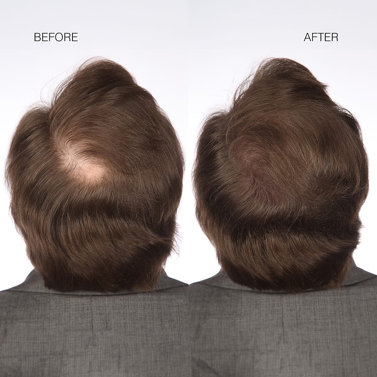 Hairmax Hair Fibers- Black image number 6