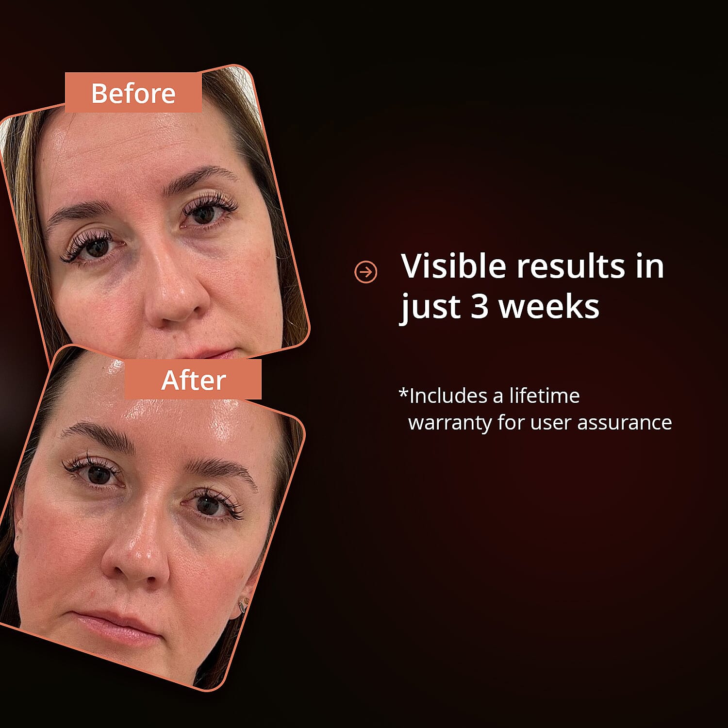 Opatra Cleo Gold LED Rejuvenation Mask (Lifetime Warranty)