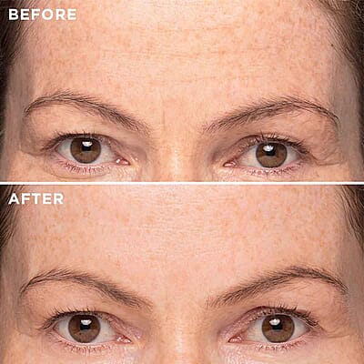 MIE Targeted Deep Line Elixir- Reduces Lines, Wrinkles, Plumps & Hydrates (0.17oz)