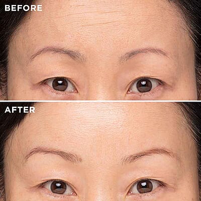 MIE Targeted Deep Line Elixir- Reduces Lines, Wrinkles, Plumps & Hydrates (0.17oz)