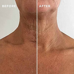 MIE Rejuvenating Neck and Chest Serum- Revives & Restores Delicate Skin (1oz)