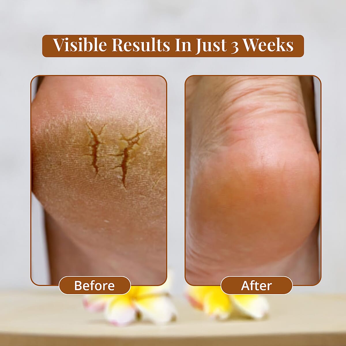 My2Feet Professional Electric Callus Remover (Manufacturer Warranty) image number 4