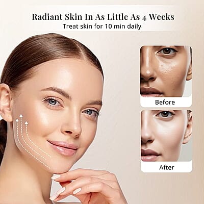 Mirabella FDA Approved Phototherapy 7-Color LED Facial Mask with Infrared (1 Year Vendor Warranty)