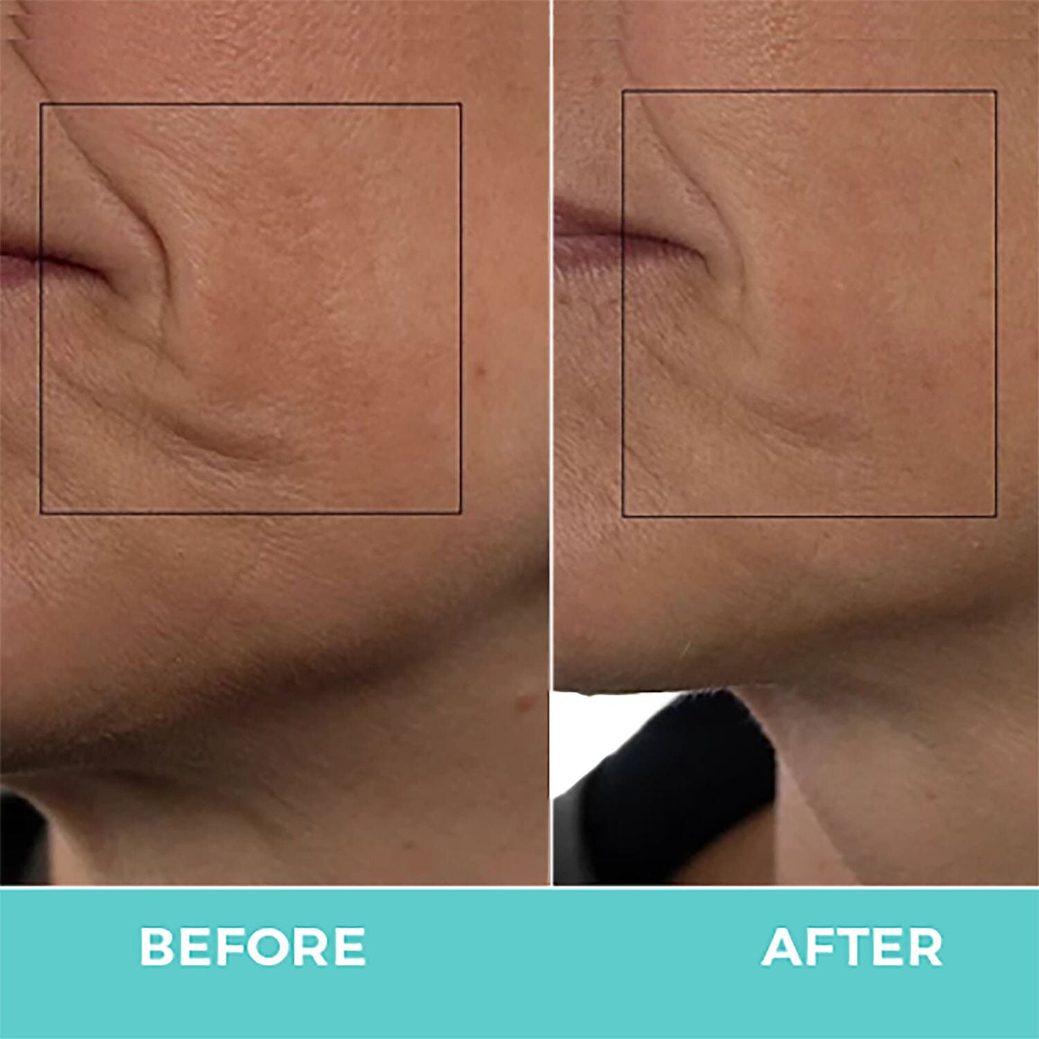 Default Title - Product card gallery slide 2 (10145796915483)