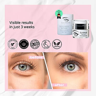 Eyetitude NoCrowZ Retinol Eye Cream (15ml)