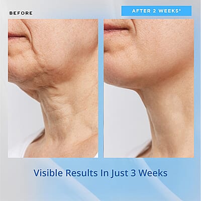 Clinical Results 24/7 Nutrient-Rich Plasma Neck & Chest Balm (3.3oz) Made in US