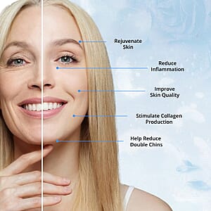 IGIA Chin-Fit Elite Face Shape EMS Massager