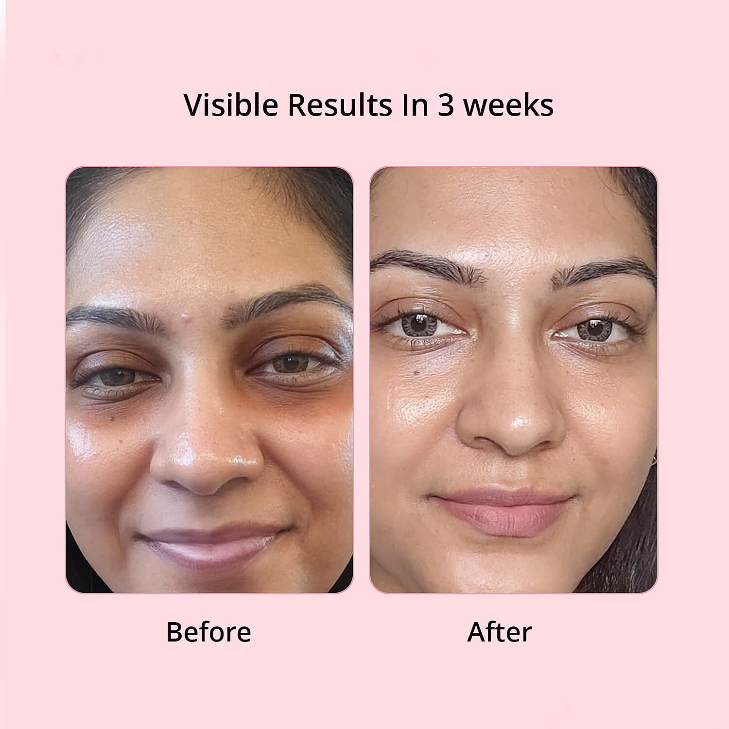 Default Title - Product card gallery slide 3 (10145974747419)