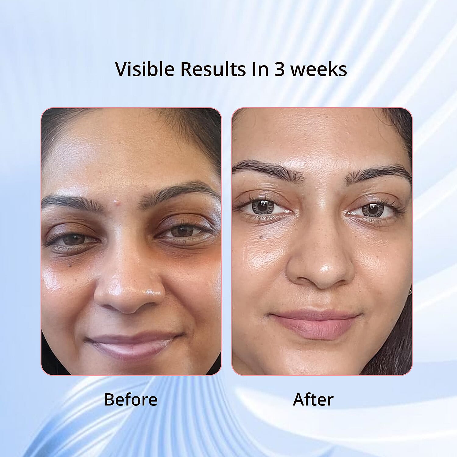 PROBIOTIC Radiance Overnight Repairing Serum (1.01oz)