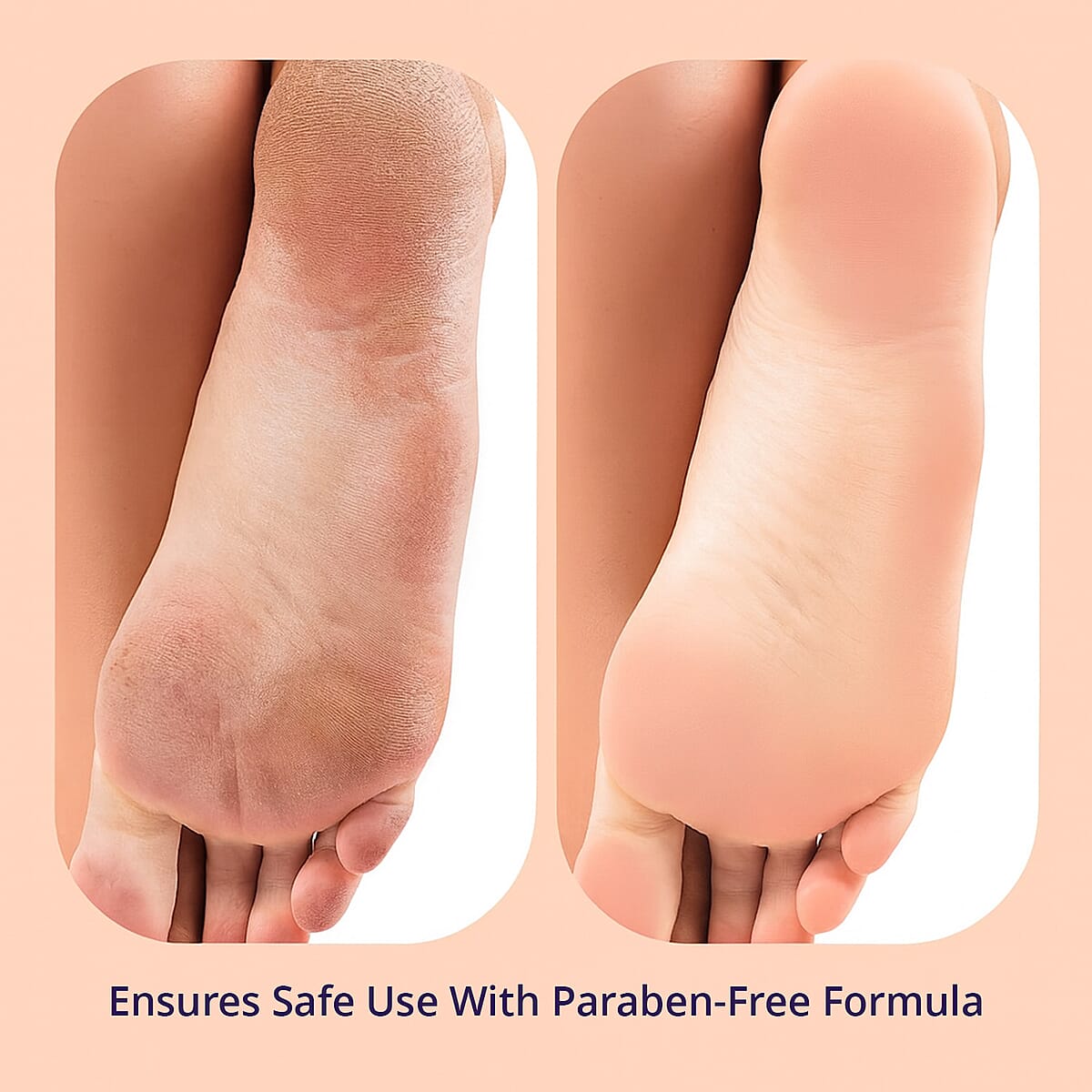 SpaLife Vitamin C Moisturizing Foot Cream & Brown Sugar Scrub - Duo Pack image number 5