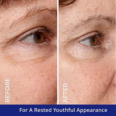 NutriVedic Brightening and De-Puffing Eye Cream