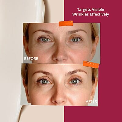 ALPHA Skincare Enhance Wrinkle Repair Cream with 15% Retinol (1.05oz)