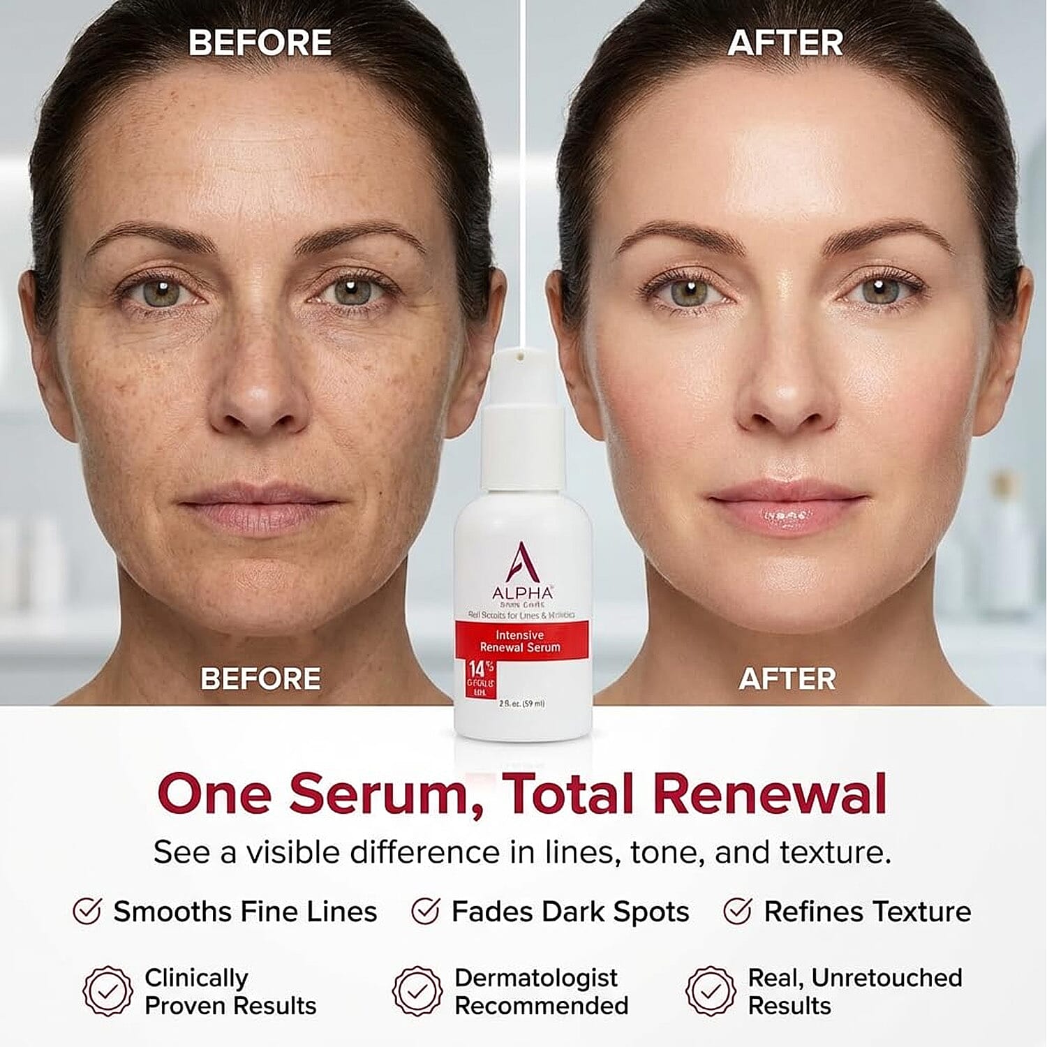 Intensive Renewal Serum 14% Glycolic AHA