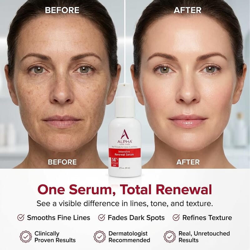 Intensive Renewal Serum 14% Glycolic AHA