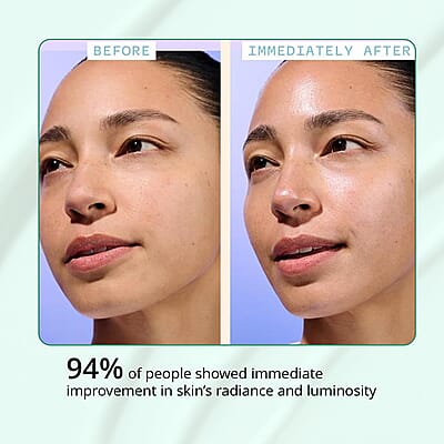 Clinical Results 24/7 Matrixyl 100% Trifecta Matrixyl & Argireline Micro Needling Ampoules Kit