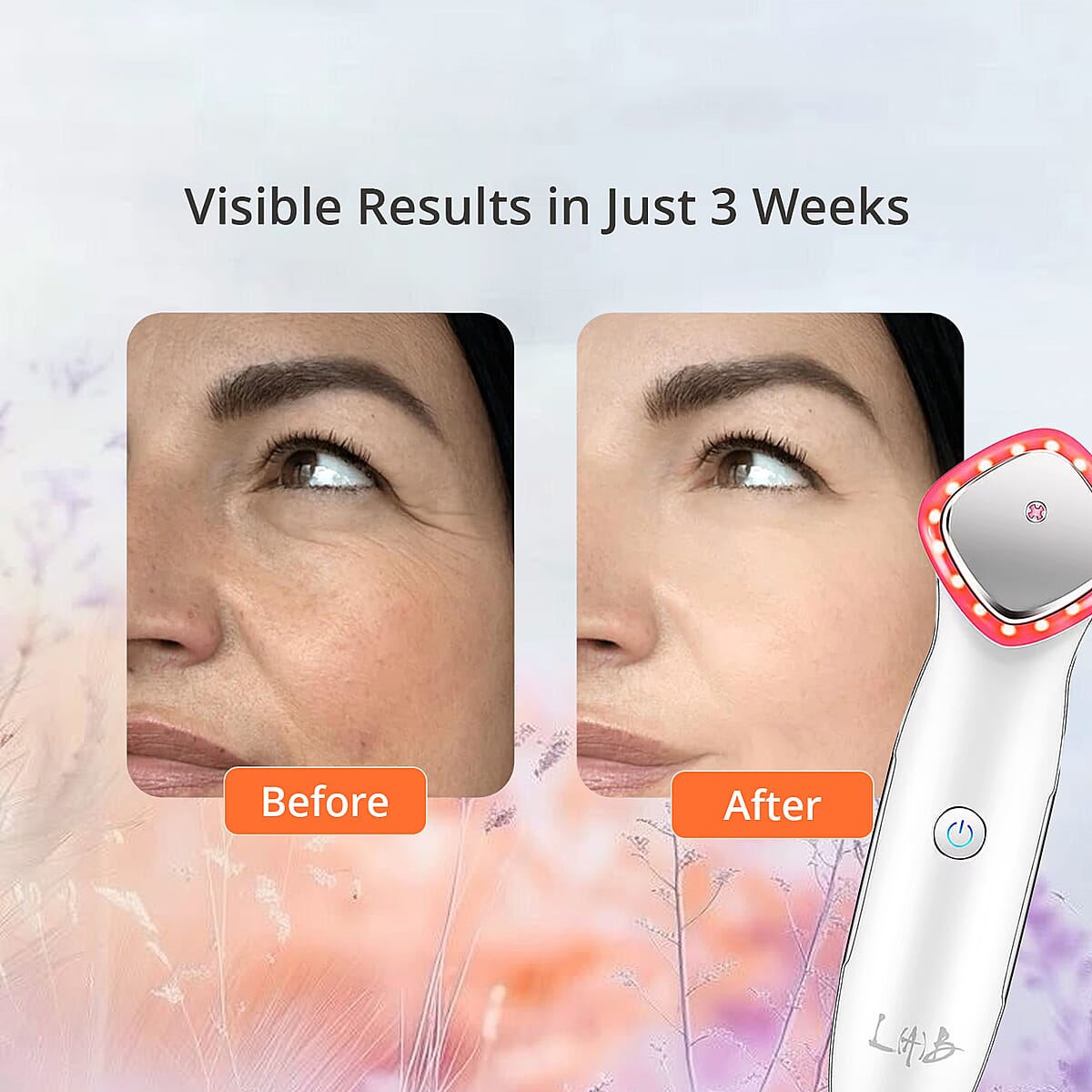 LAB Iontopheresis EMS, LED, Galvanic & Micro Current, Thermal Therapy Device with Conductive Cartridges (Lifetime Warranty) image number 4