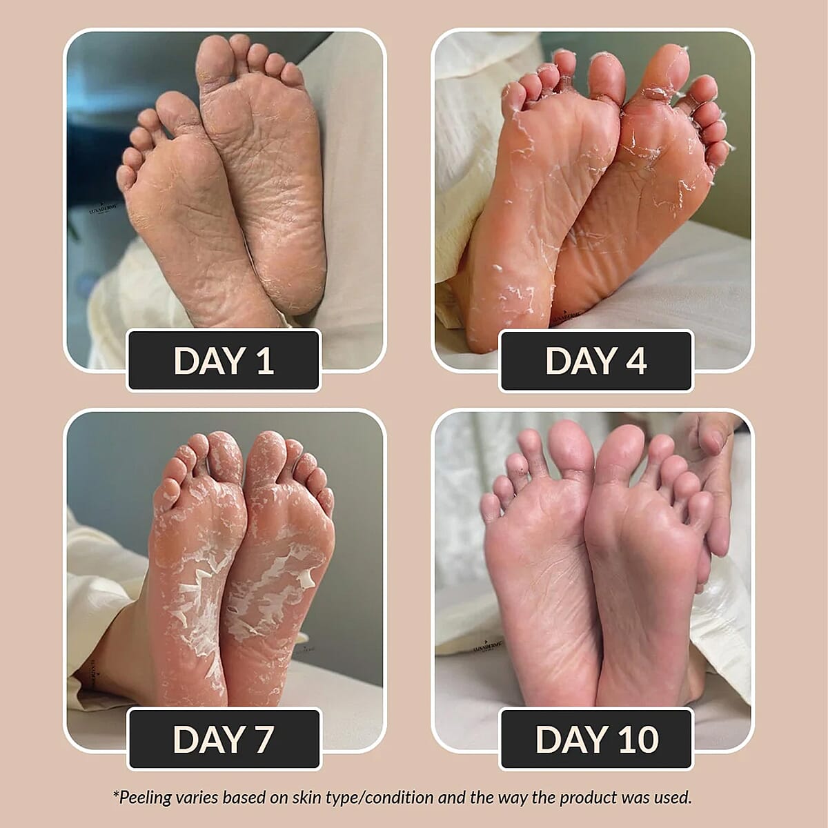 Purederm Set of 6 Botanical Choice&trade; Intensive Healing Foot Mask (1pair x6) image number 5