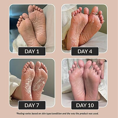 Purederm Set of 6 Botanical Choice™ Intensive Healing Foot Mask (1pair x6)